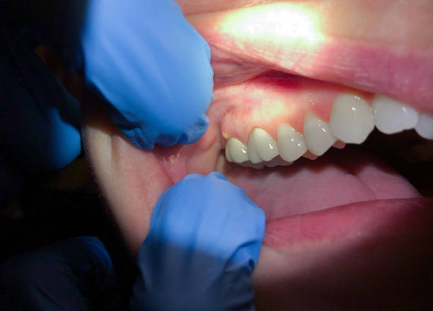 Best Pediatric Emergency Dentist in Berlin, MD